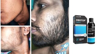 mintop minoxidil 5 beard  minoxidil beard growth  how to grow beard derma roller for beard growth [upl. by Holbrooke]