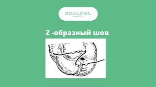 Z образный шов  Zshaped seam [upl. by Bax902]