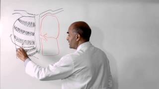 Lobectomy of Lung  How is it Performed [upl. by Adle36]