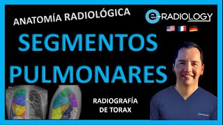 🥇Los SEGMENTOS PULMONARES 🫁  ANATOMIA RADIOLOGICA  Radiología para ESTUDIANTES [upl. by Arualana]