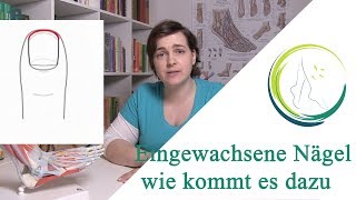 Eingewachsene Nägel wie kommt es dazu podologinandrea [upl. by Nnazus]