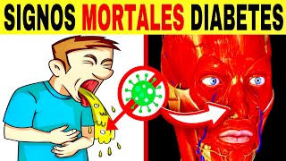 7 SIGNOS MORTALES de DIABETES que no puedes ignorar cetoacidosis diabética [upl. by Oneill270]