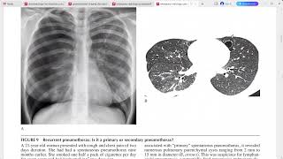 EMERGENCY RADIOLOGY CASE STUDIES [upl. by Screens]