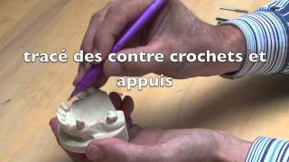 Etude de linsertion en prothèse partielle amovible coulée [upl. by Chem316]