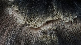 ASMR Immersive Scalp Examination No Talking 42 [upl. by Way]