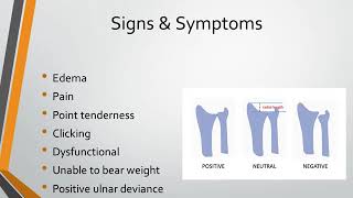 Triangular Fibrocartilage Complex Injury [upl. by Clive]