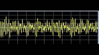 Infections  Rife Frequencies [upl. by Atneciv]