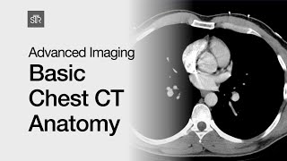 Advanced Imaging Basic Chest CT Anatomy [upl. by Lenore81]