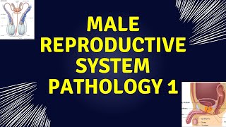 pathoma male reproductive system penis and testicle pathology [upl. by Ttam]