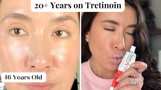 Tretinoin The Best Topical AntiAging Cream See my Skin amp What Ive learned After 20 yrs of Use [upl. by Obnukotalo720]