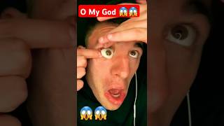 MY EYEBALL SLIPPED OUT 😱shorts viralshort trending ytviral comedy funny song [upl. by Oisorbma400]