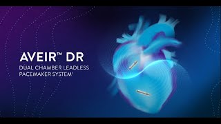 AVEIR DR™ Dual Chamber Leadless Pacemaker System 3D Implantation Simulation [upl. by Dorran]