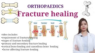 Fracture Healing  Stages of fracture healing  primary vs secondary bone healing  factors affec [upl. by Ainez]