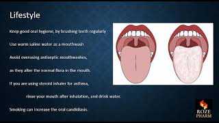 Oral candidiasis thrush Miconazole Nystatin Amphotericin B Roze pharm [upl. by Hammond]