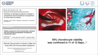 Chondral matrix transplantation  what to expect  K Günther [upl. by Larianna]