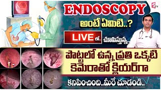 కడుపులో సమస్యలు  Know About Colonoscopy And Endoscopy  Gleneagles Hospital  DrGSSameer Kumar [upl. by Nwahsyar]