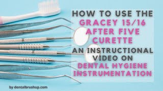 How to use the Gracey 1516 After Five Curette [upl. by Brock]