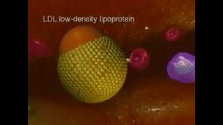 Biology of progression of atherosclerosis [upl. by Ahsinna]