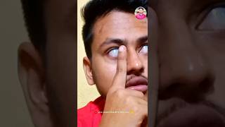 Eye 👁️ challenge video shorts shortsvideo shortsfeed shortsviral trendingshorts [upl. by Naras]