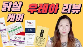 거칠거칠 닭살피부 케어 우레아 성분 리뷰 ✅ 디오디너리 우레아 함유 크림⎪유세린 크림 후기⎪우레아 유레아 유리아 Urea 피부 효능⎪모공 각화 굳은 살 각질 극건성 보습제 [upl. by Stormie]