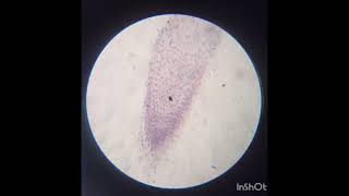 Microscopic view of Mitosis stages in Onion Root Tip microscopic mitosis prophase metaphase [upl. by Dihgirb169]