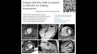 Snippet 164 Why CMR is Better than PET for Viability Assessment [upl. by Edora432]