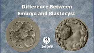 What is the difference between an Embryo and Blastocyst  IVF Specialist [upl. by Xuerd928]