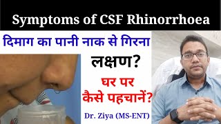 CSF Rhinorrhea घर पर कैसे पहचानें Naak se Pani aana Leaking of brain fluid through nose [upl. by Nevile]