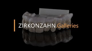 Prettau® Bridge on 4 implants  ZirkonzahnGalleries [upl. by Manvil]