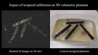 Skeleton Graphbased UltrasoundCT Nonrigid Registration [upl. by Ahsytal891]