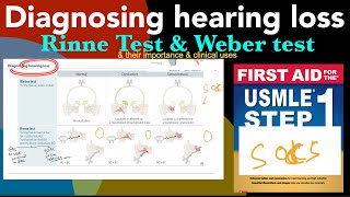 Diagnosing hearing loss  Rinne test amp Weber test amp their clinical uses amp importance in HindiUrdu [upl. by Renaldo]