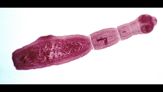 Echinococcus Multilocularis  The Small Fox Tapworm [upl. by Jerrilee]