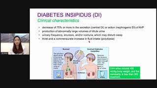 Disorders of the hypothalamus and the pituitary PART 6 Disorders of the posterior pituitary [upl. by Conal]