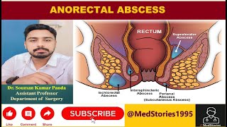 Anorectal Abscess Lecture [upl. by Zemaj990]