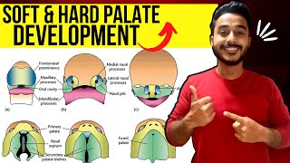 development of palate embryology  soft palate development embryology [upl. by Ngo]