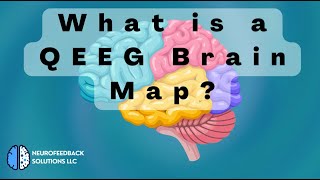 What is a QEEG Brain Map [upl. by Lyndy]