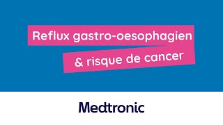 Reflux gastrooesophagien amp risque de cancer associé [upl. by Nove398]