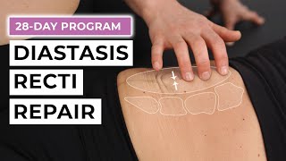 28Day Diastasis Recti Repair Program FREE Challenge [upl. by Henriques756]