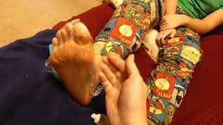 Curing Athletes Foot Fast  Iodine Antifungal Cream and Saran Wrap [upl. by Mecke]