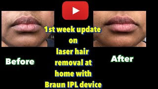 1st SessionHair Removal at homeBraun IPLtamiltrendingbraunfacialhairremovalforwomen [upl. by Ohcirej669]