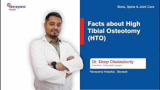 Understanding of High Tibial Osteotomy HTO Insights from Dr Deep Chakraborty [upl. by Eusebio399]