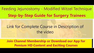 Feeding Jejunostomy Complete Guide FJ amp TG Series Part 33  See Video Description for Details [upl. by Karoly]