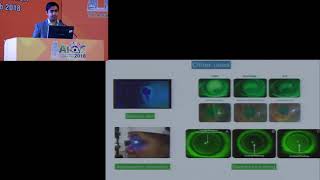 AIOC2018  GP063  Topic  Corneal Staining Techniques  7 mins [upl. by Abagail]