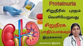 சிறுநீரில் புரதம் போவதால் காணப்படும் அறிகுறிகள் Proteinuria causes and symptoms [upl. by Tolmach]