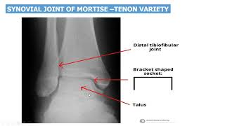 Ankle Joint Anatomy anatomy revision with questions and answers [upl. by Groh364]