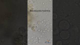 Blastocystis hominis in Stool [upl. by Augustine]