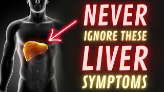 Pay Attention To These Liver Symptoms Before Its Too Late [upl. by Ykcin]