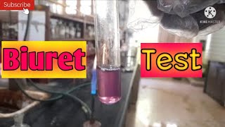 Biuret test  Confirmative Tests for Urea [upl. by Nauq891]