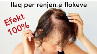 ILAQ NATYRAL PER RENJEN E FLOKEVE  100 EFEKT  Maska per floke  floket receta hairgrowth [upl. by Aid]