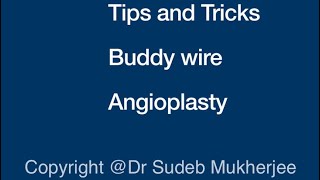 Angioplasty Buddy Wire Tips and Tricks [upl. by Raviv]